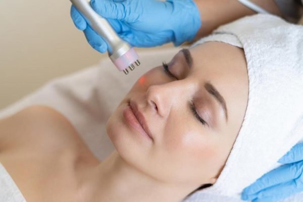 Microdermabrasion courses