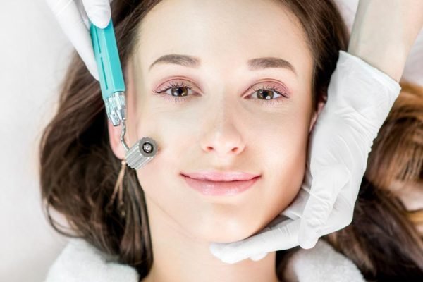 Micro needling
