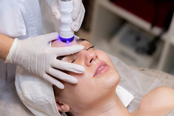 laser skin Rejuvenation